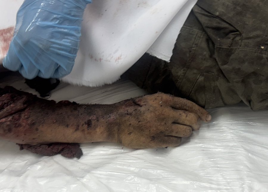 Image for the event titled: Mohammad Nofal's body: mangled arm, declares Shahada with index finger