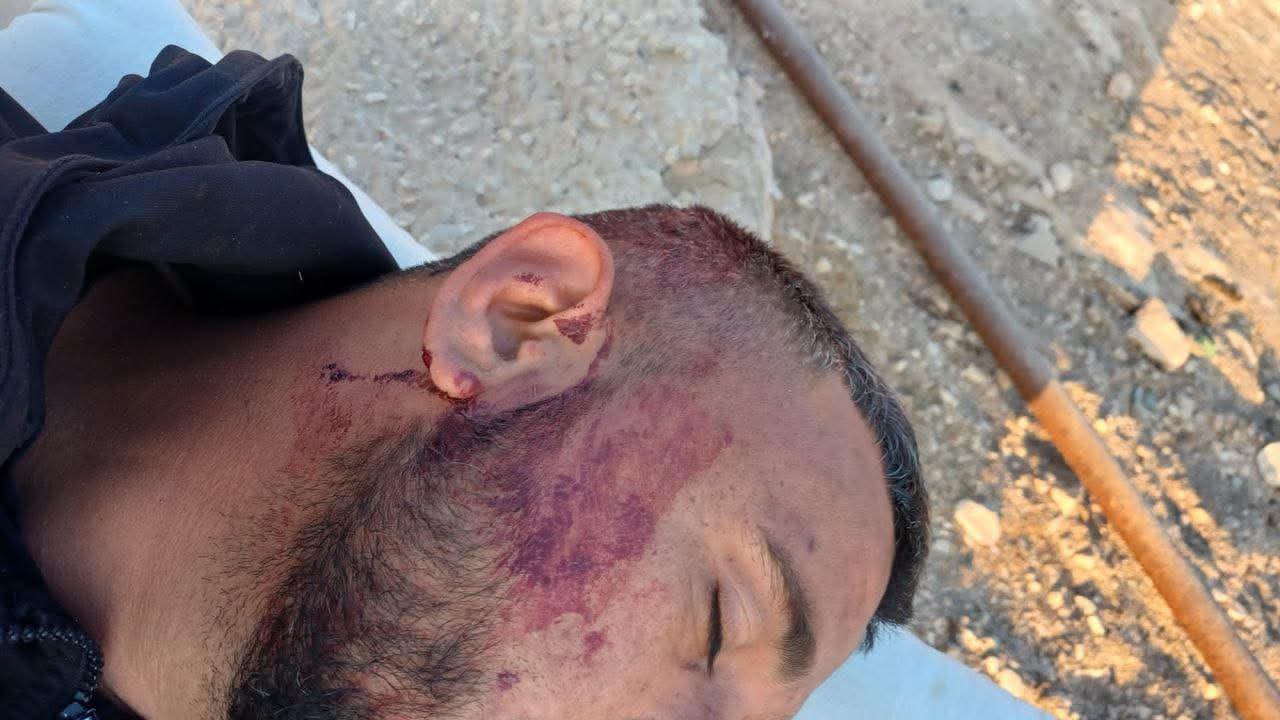 Thumbnail preview image for the video titled: Two residents of the village of Umm al Khair were brutally attacked by Israeli settlers
