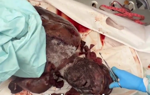 Thumbnail preview image for the video titled: Israel returns the bodies of Palestinians it tortured to death without any identification