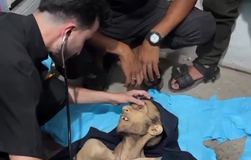 Thumbnail preview image for the video titled: Mohammad al-Sawafiri, a person with special needs, has just died of malnutrition
