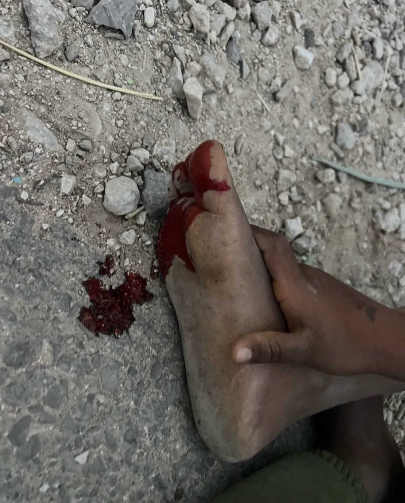 Thumbnail preview image for the video titled: Brutal attack by settlers in Umm al Khair, injuring three residents: a child, a woman and an activist