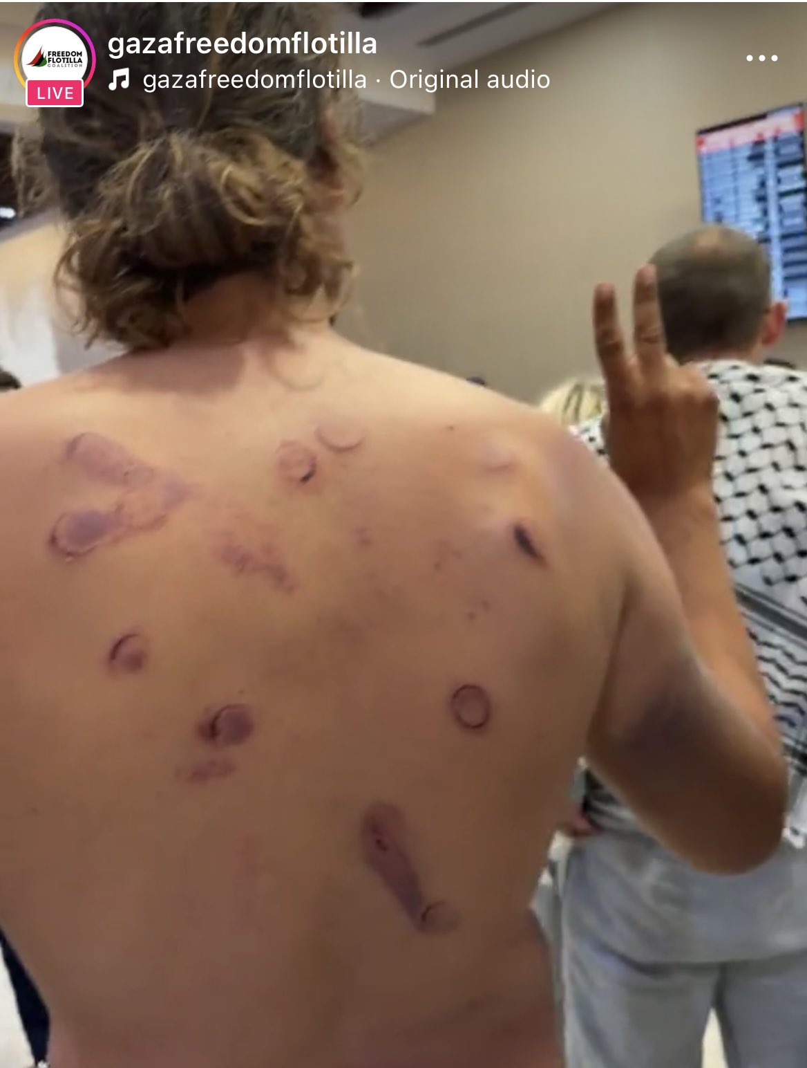 Thumbnail preview image for the video titled: Adrian Jouan shows evidence of torture inflicted by Israeli soldiers on his body