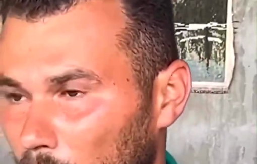 Thumbnail preview image for the video titled: Testimony of Fady Baker recounting the 45 days he spent in the Sde Teiman torture camp