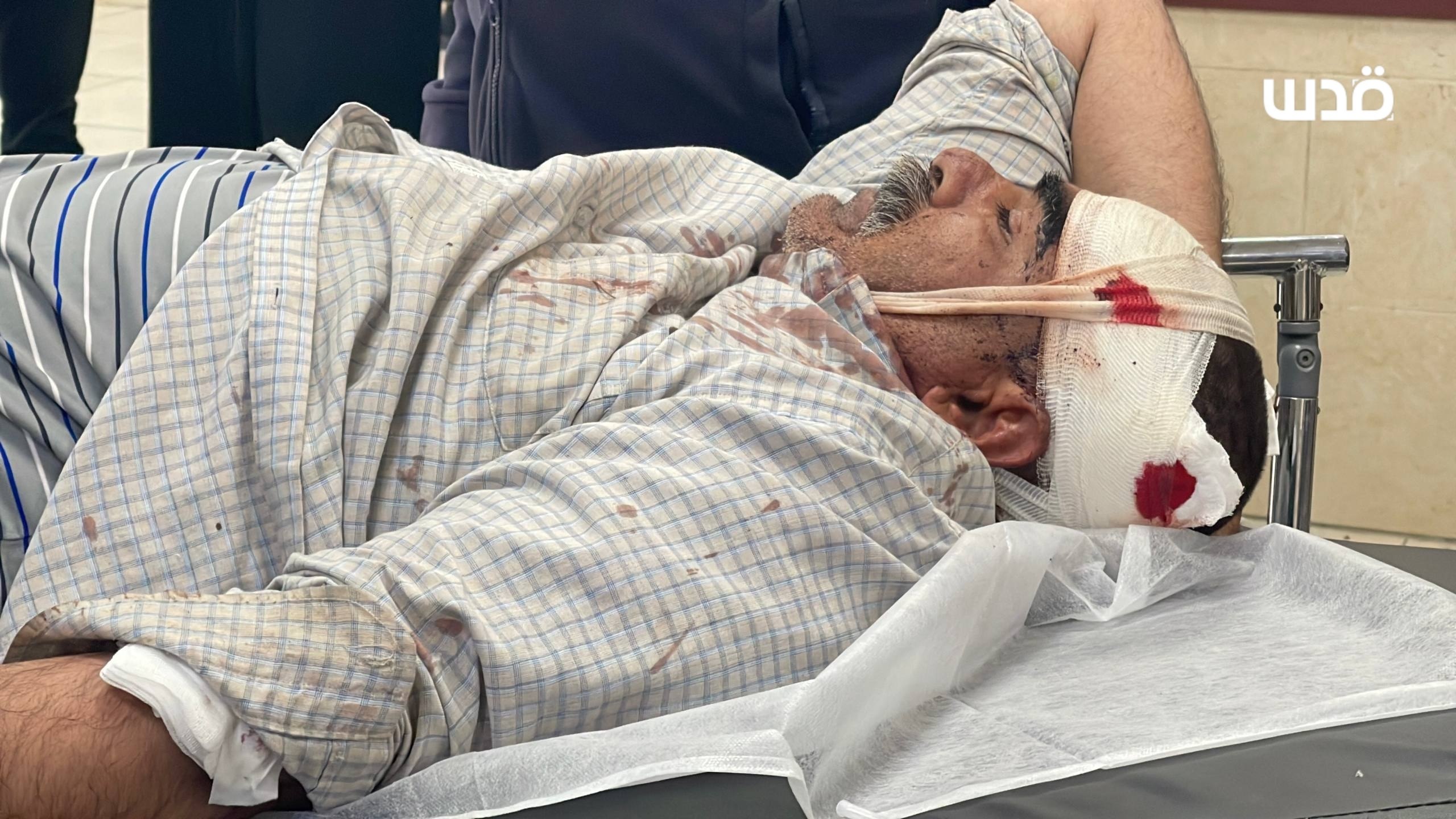 Thumbnail preview image for the video titled: Palestinian injured by live ammunition and physical assault during an attack by Israeli settlers on the village of Madama