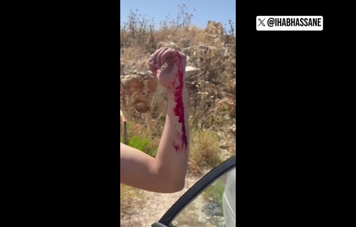 Thumbnail preview image for the video titled: Israeli settler attacked a father and his son in the village of Shouqba in the West Bank while they were working their land