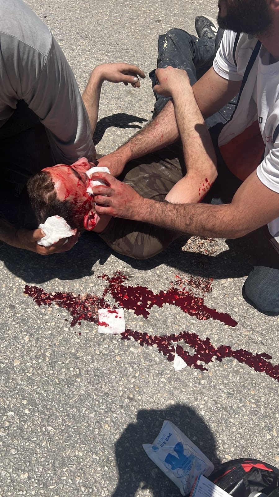 Thumbnail preview image for the video titled: A Palestinian man severely injured during the pogrom carried out by Israeli settlers and soldiers in Huwara