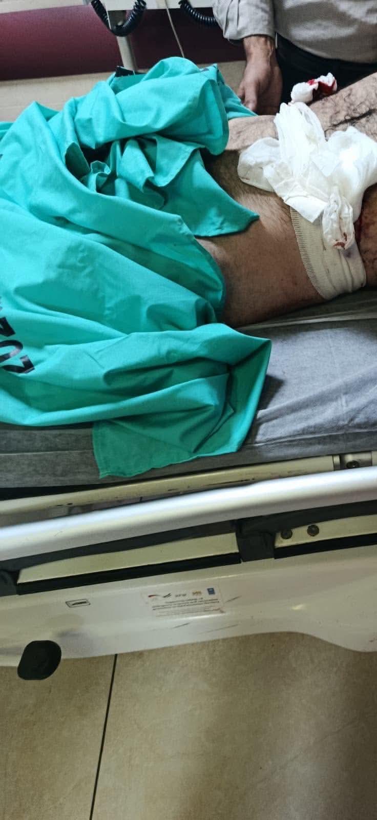 Thumbnail preview image for the video titled: Settlers shot and injured a Palestinian with special needs near Duma