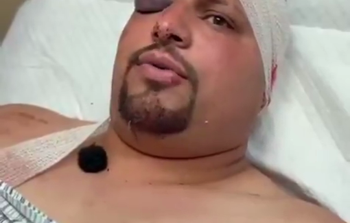 Thumbnail preview image for the video titled: Pogrom in Deir Abu Mashal/ testimony of injured Sanad Zahran