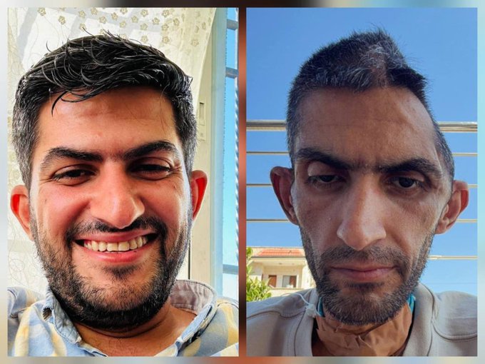 Thumbnail preview image for the video titled: Palestinian journalist suffers severe brain hemorrhage following months of Israeli prison abuse