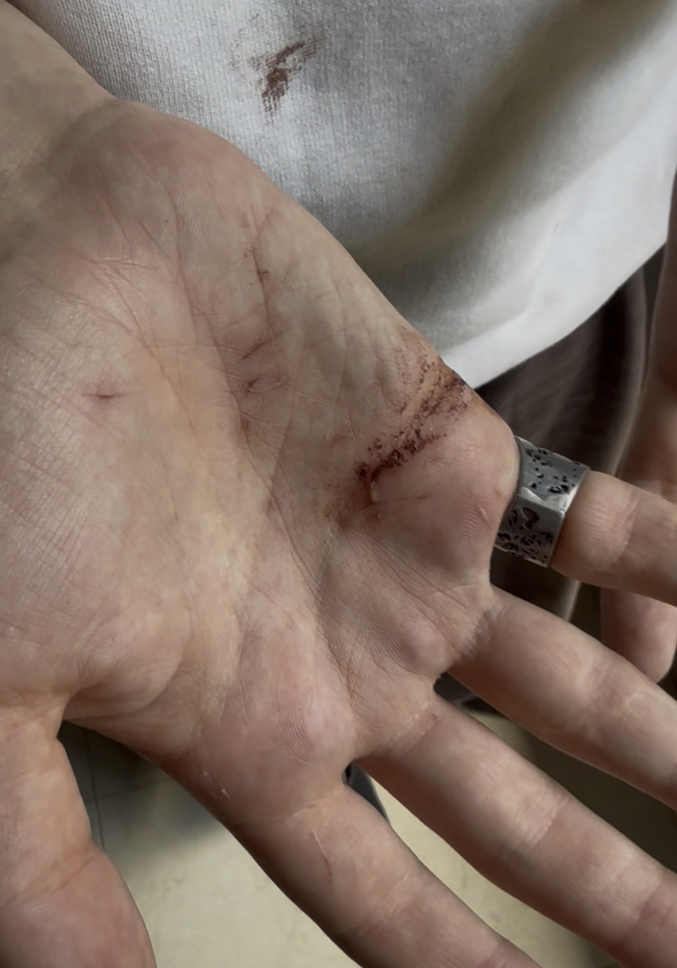 Thumbnail preview image for the video titled: Massive settler attack on Umm Al Khair with razor wire and small arms