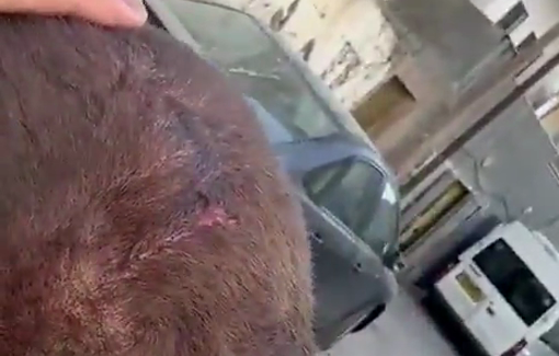 Thumbnail preview image for the video titled: Israeli forces assaulted and beat the Palestinian Mohammed Jamal Ammar, from Qalandia RC