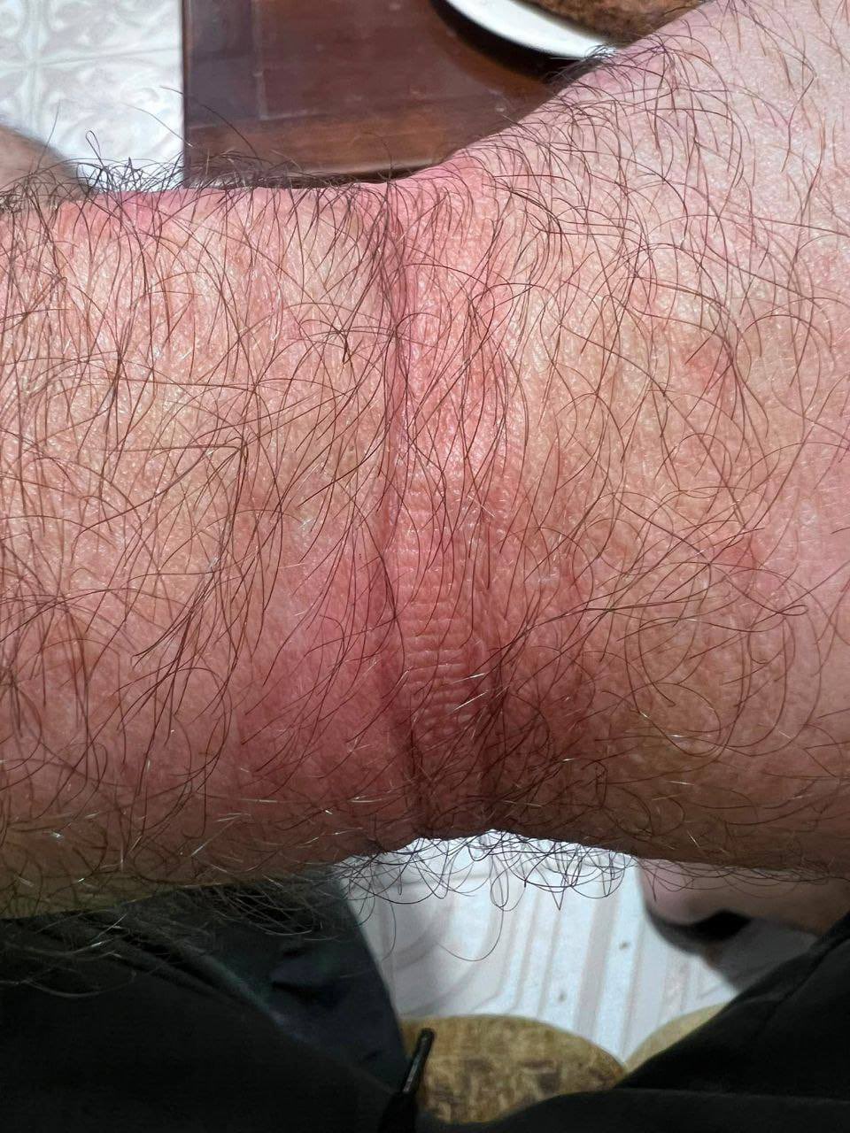 Thumbnail preview image for the video titled: In Qalandia RC, a detainee released by Israeli forces showed wrist marks from tight plastic restraints
