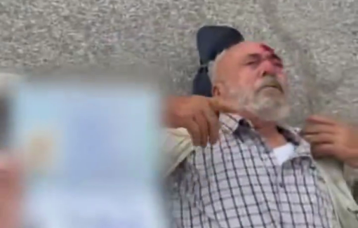 Thumbnail preview image for the video titled: An 82-year-old American has been left bleeding from his head after Israeli soldiers flashbanged him in the village of Turmusayya
