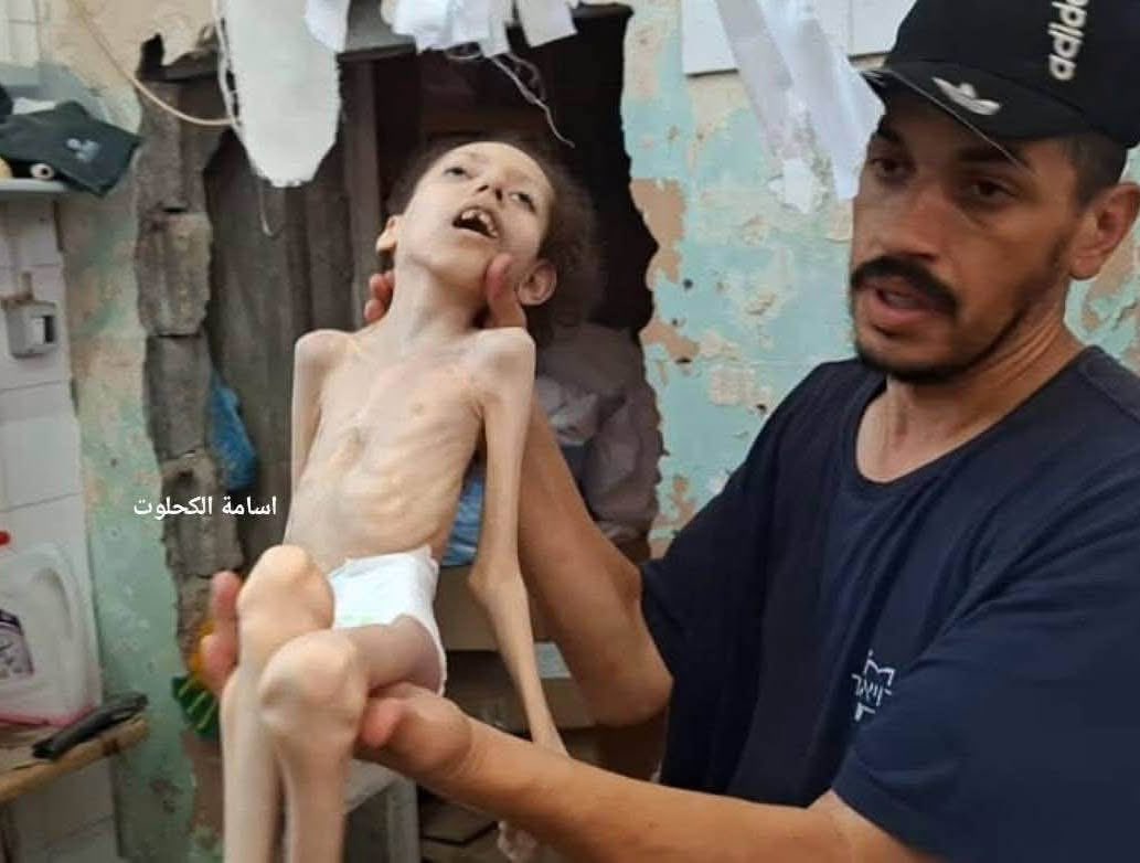 Thumbnail preview image for the video titled: Child Maha Bashir starved to death by Israel's policy of restricting essential aid to Gaza