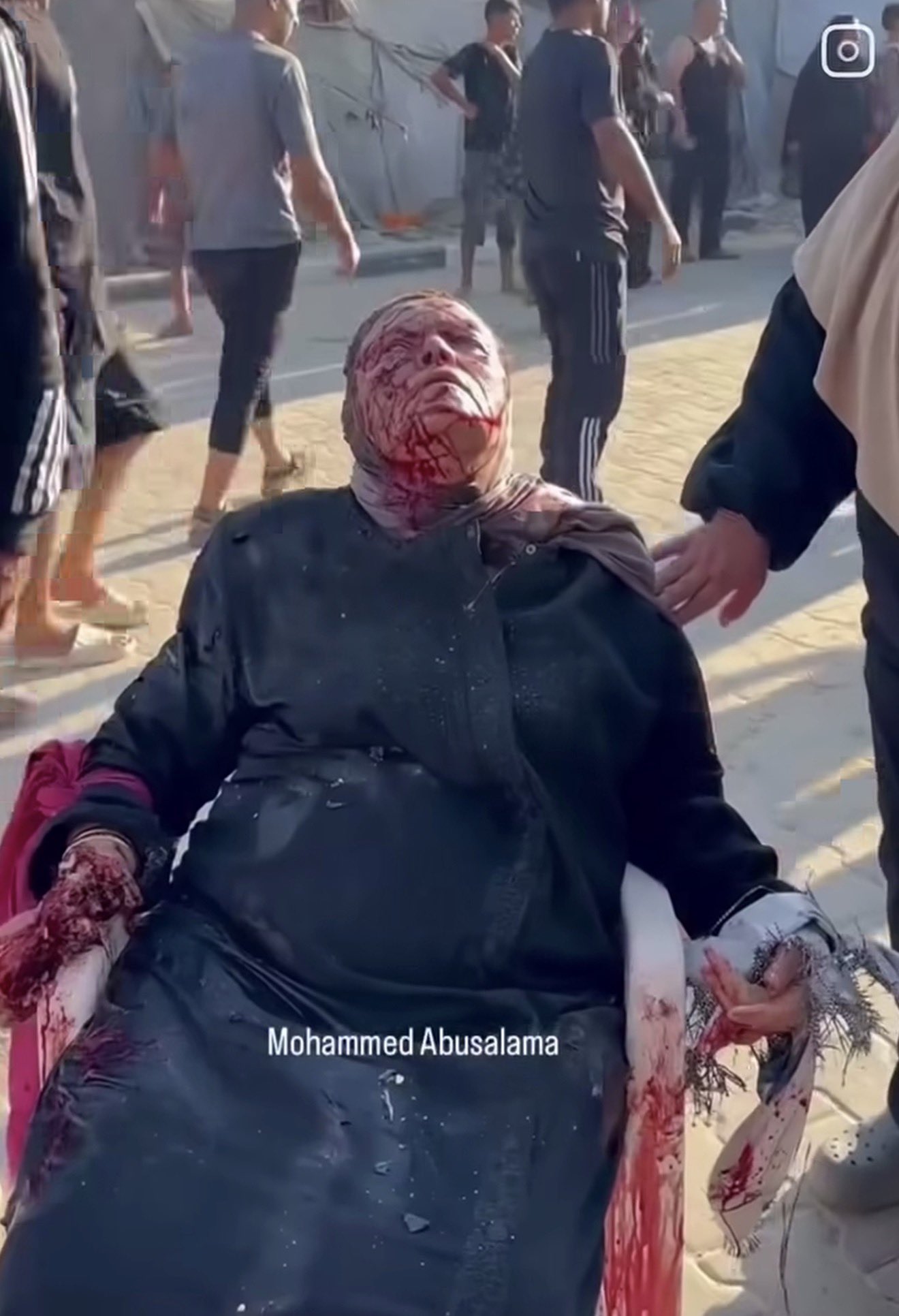 Thumbnail preview image for the video titled: Elderly mother's hand severed in Israel bombing of Gaza Port cafe that also killed her son