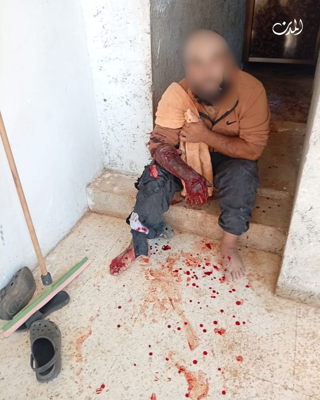 Thumbnail preview image for the video titled: Syrian truck driver injured by Israel's airstrike on his vehicle