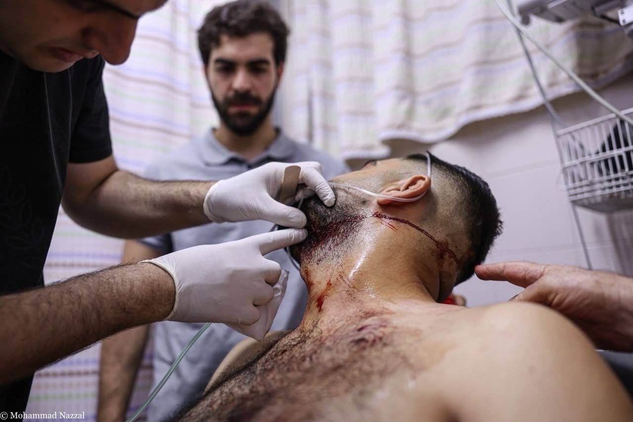 Thumbnail preview image for the video titled: Wounded arriving at Darwish Nazzal Government Hospital after the deadly pogrom in Hajjah