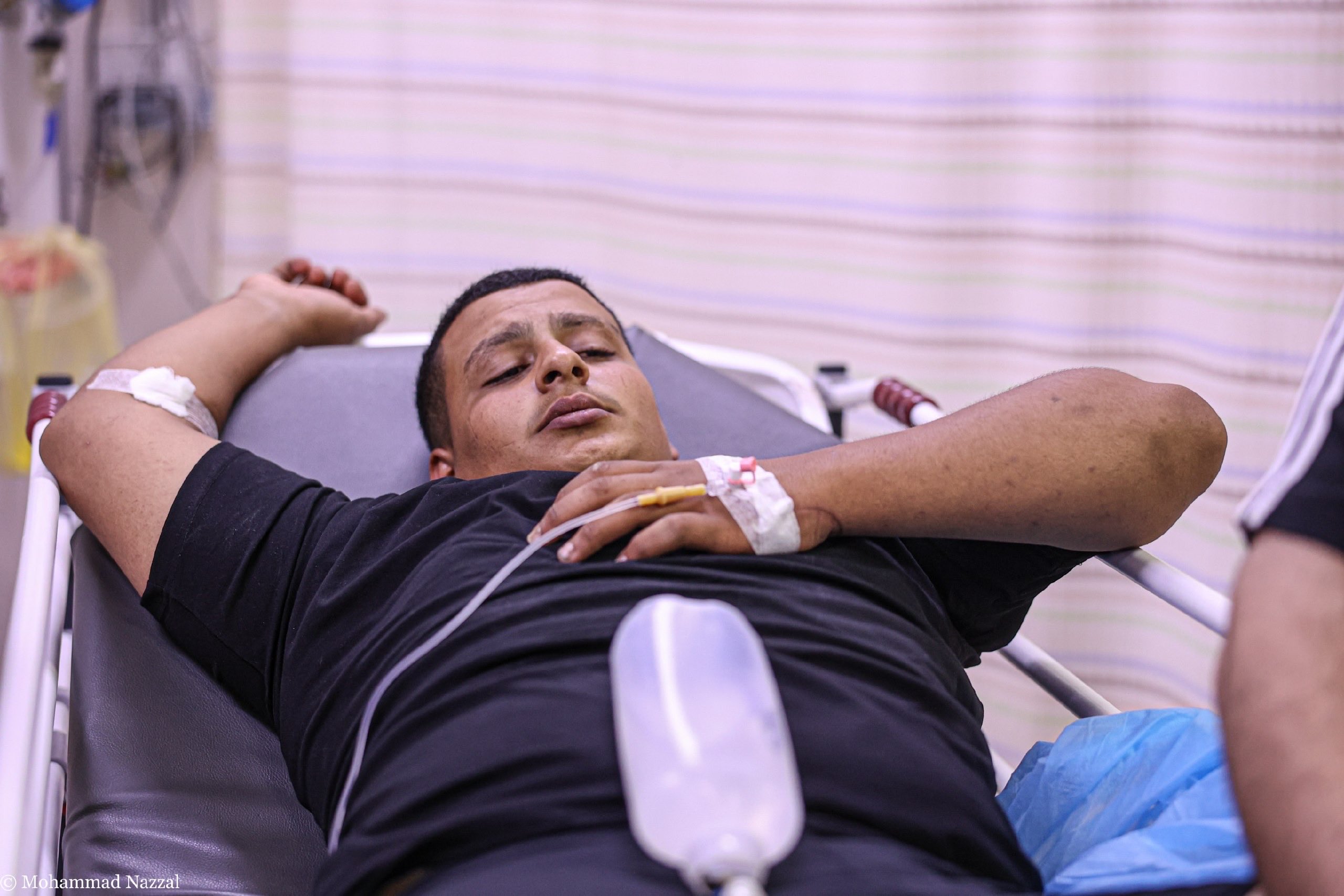 Thumbnail preview image for the video titled: Wounded people arrived at Darwish Nazzal Government Hospital in Qalqilya following a settler attack on the village of Hajjah
