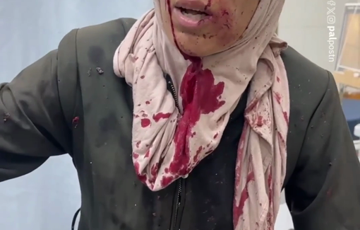 Thumbnail preview image for the video titled: Woman and children injured in deadly Israeli drone strike in Al-Mawasi