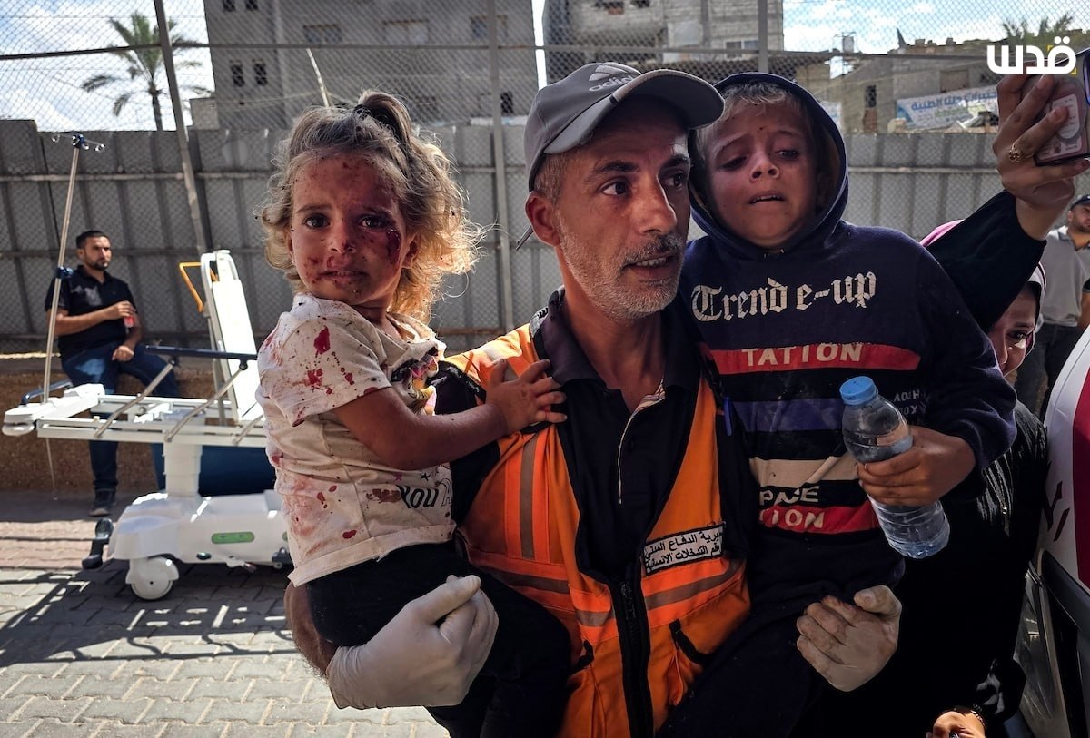Thumbnail preview image for the video titled: Children injured in Israeli drone strike in Al-Mawasi