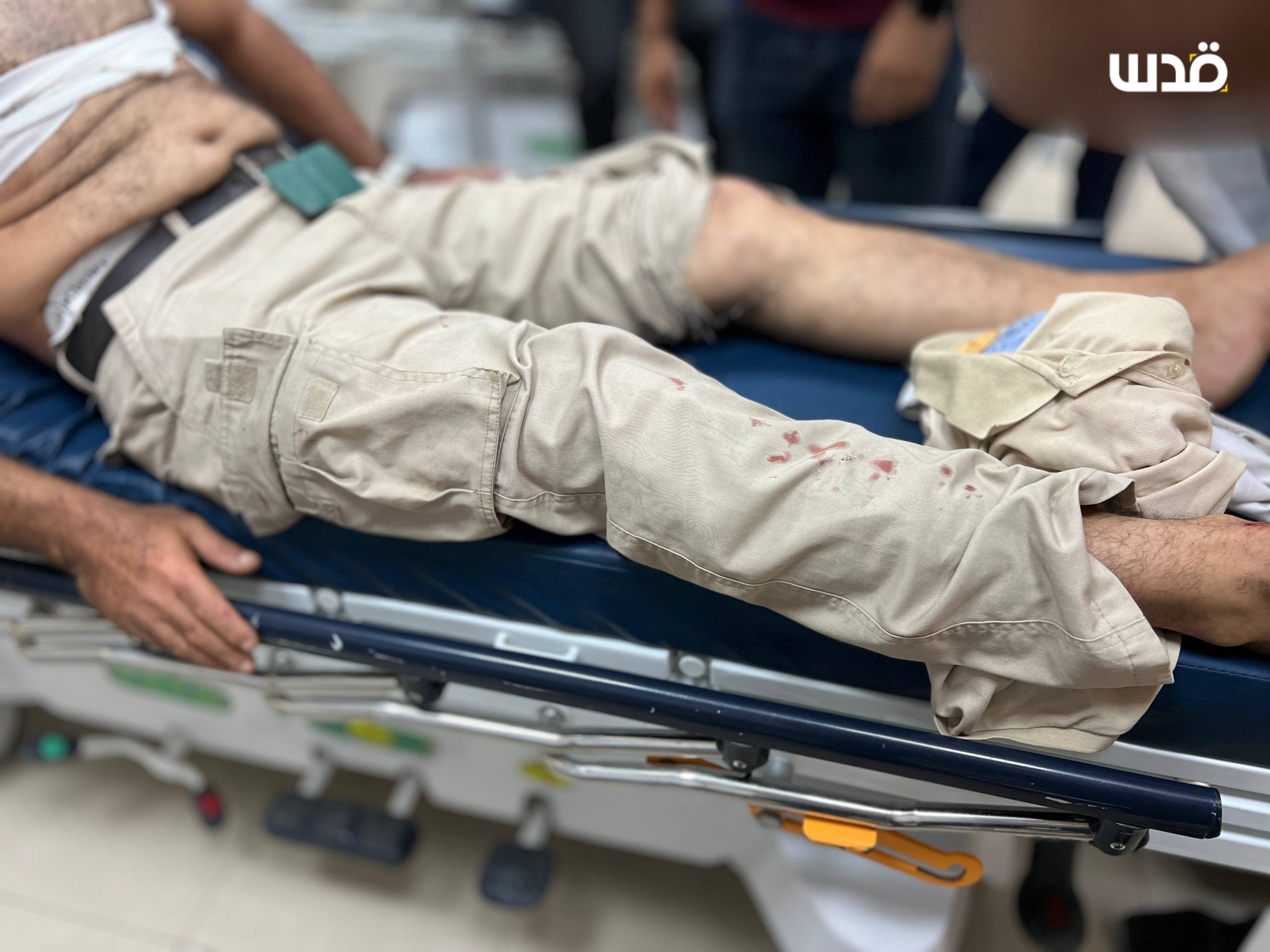 Thumbnail preview image for the video titled: Elderly UNRWA worker injured in Israeli drone strike on desalination center
