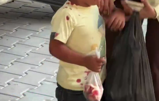 Thumbnail preview image for the video titled: Child injured in Israeli strike near a school in northern Gaza