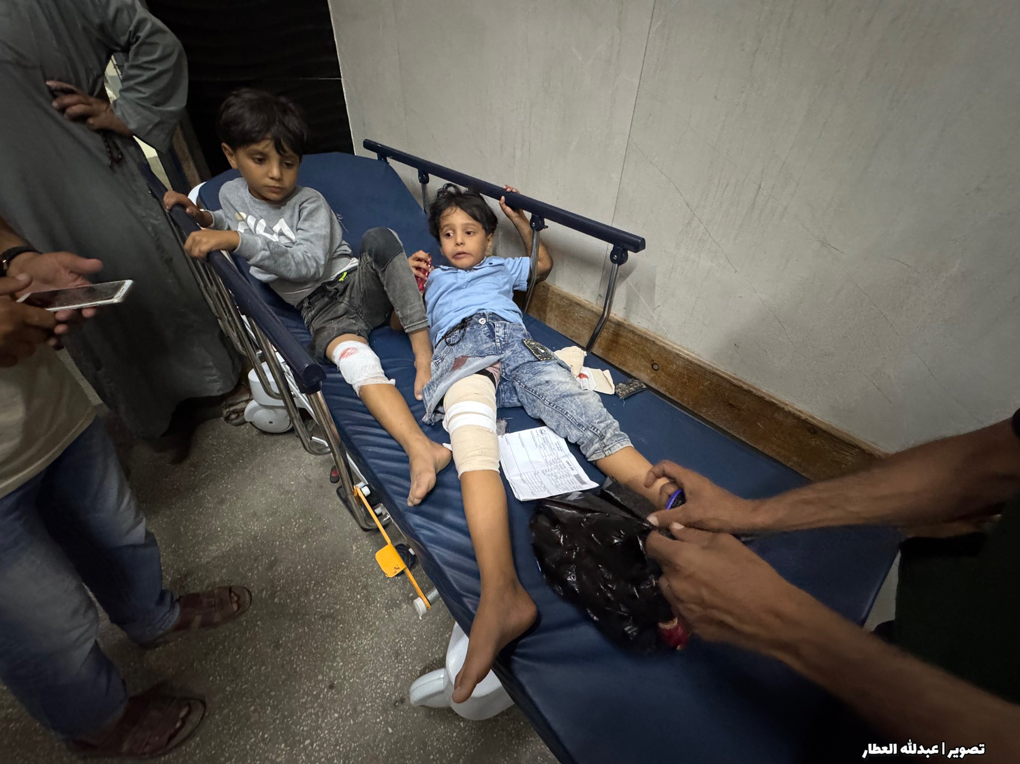 Thumbnail preview image for the video titled: Siblings Wasim and Amir Shorrab among 3 children injured by Israeli gunfire in Khan Younis
