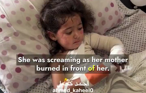 Thumbnail preview image for the video titled: Orphaned 3 year-old Maryam injured after Israel bombed her home at 4am