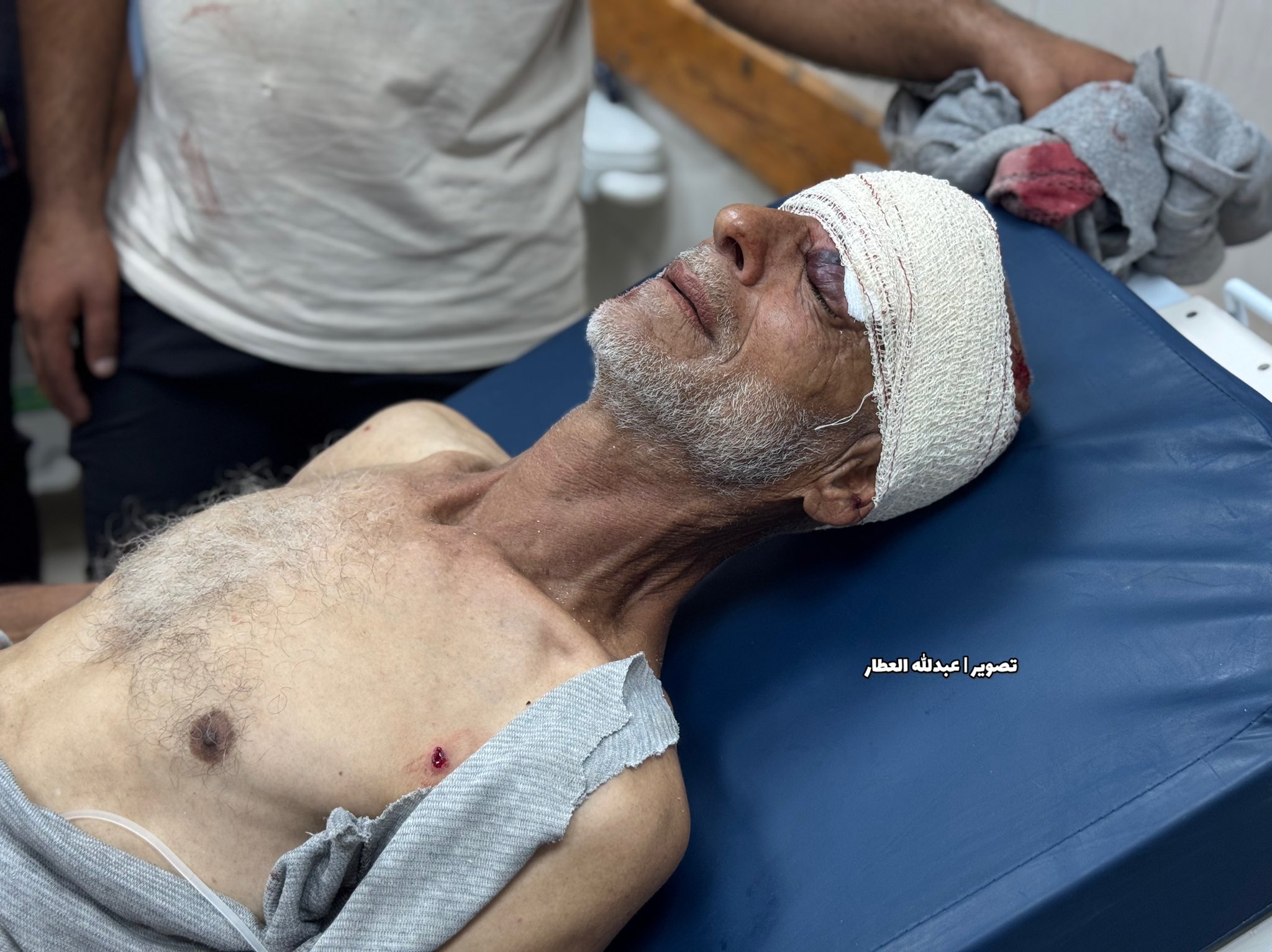 Thumbnail preview image for the video titled: Elderly injured in Israeli strike on a tent in the "safe zone"