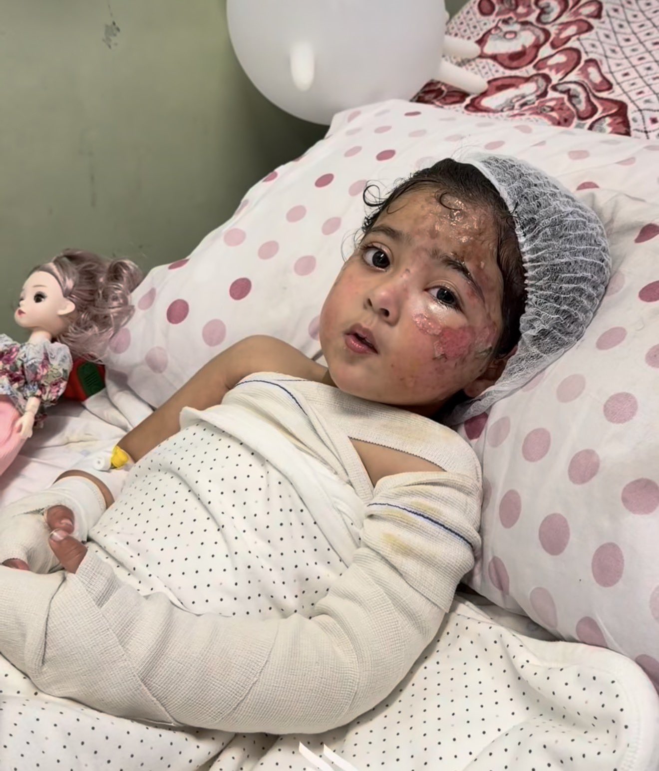 Thumbnail preview image for the video titled: Orphaned 2 year-old Maryam injured in Israeli strike that killed her mother