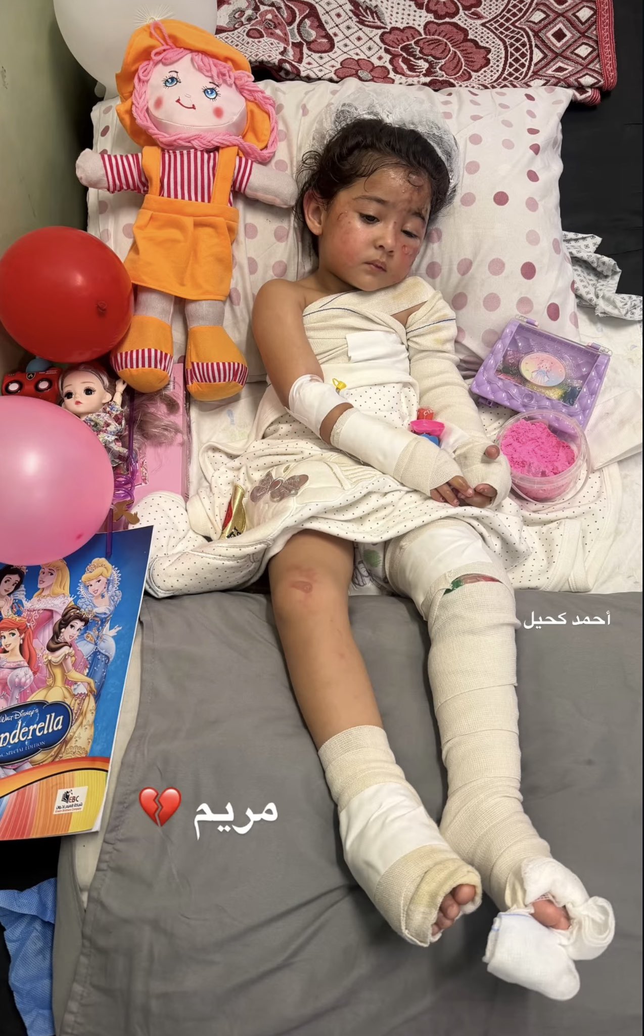 Thumbnail preview image for the video titled: Orphaned 2 year-old Maryam injured in Israeli strike that killed her mother