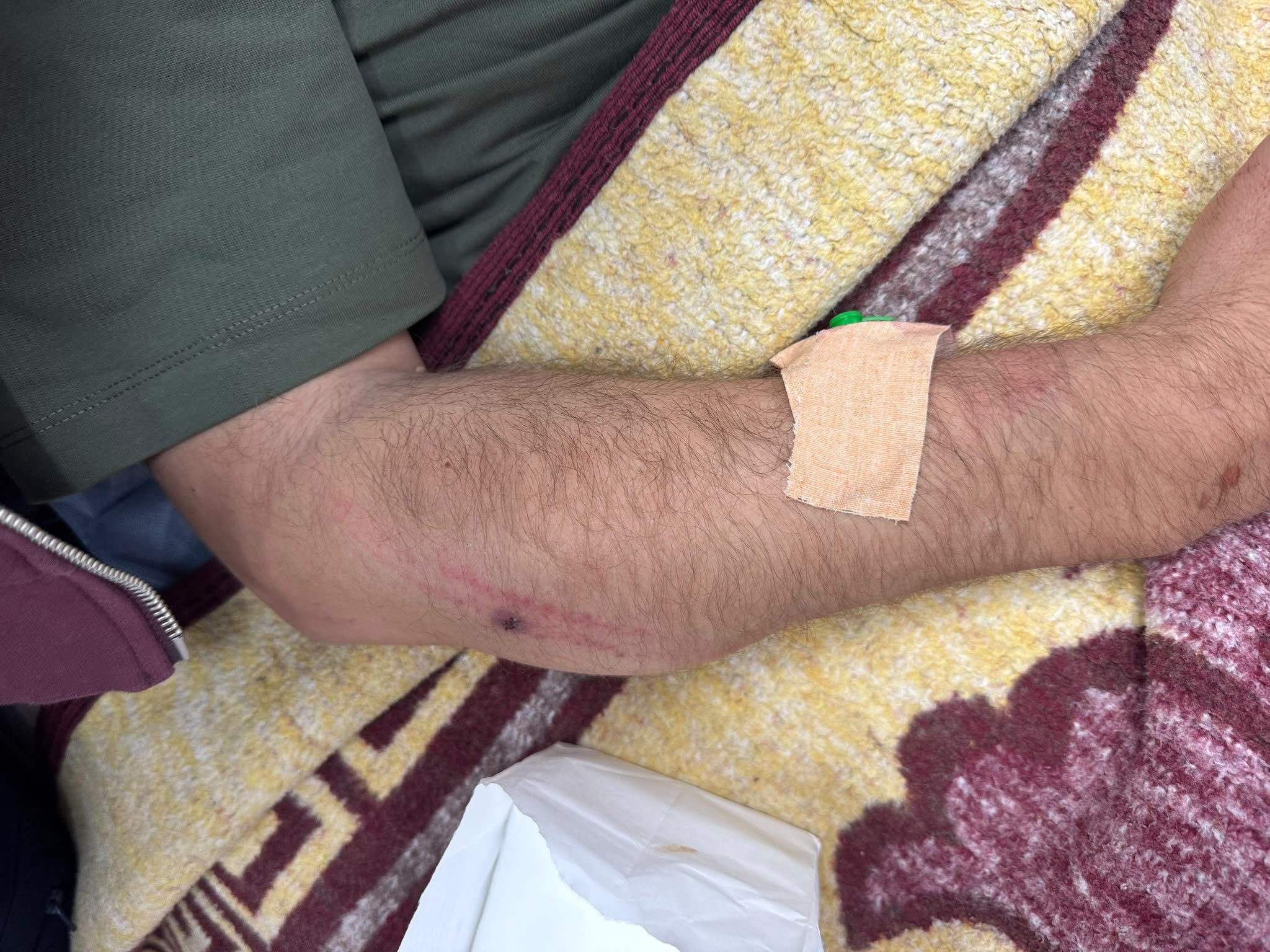 Thumbnail preview image for the video titled: A Palestinian-American citizen, Haytham Taysir, almost killed by settlers in his olive groves in Burqa,