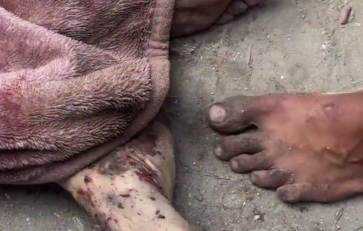 Thumbnail preview image for the video titled: Body of young Palestinian killed by Israeli strike near tents in west Gaza City