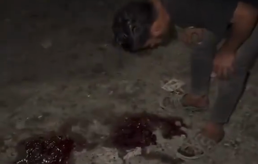 Thumbnail preview image for the video titled: Civilians collect shredded remains of victims of deadly Israeli drone strike in Gaza City