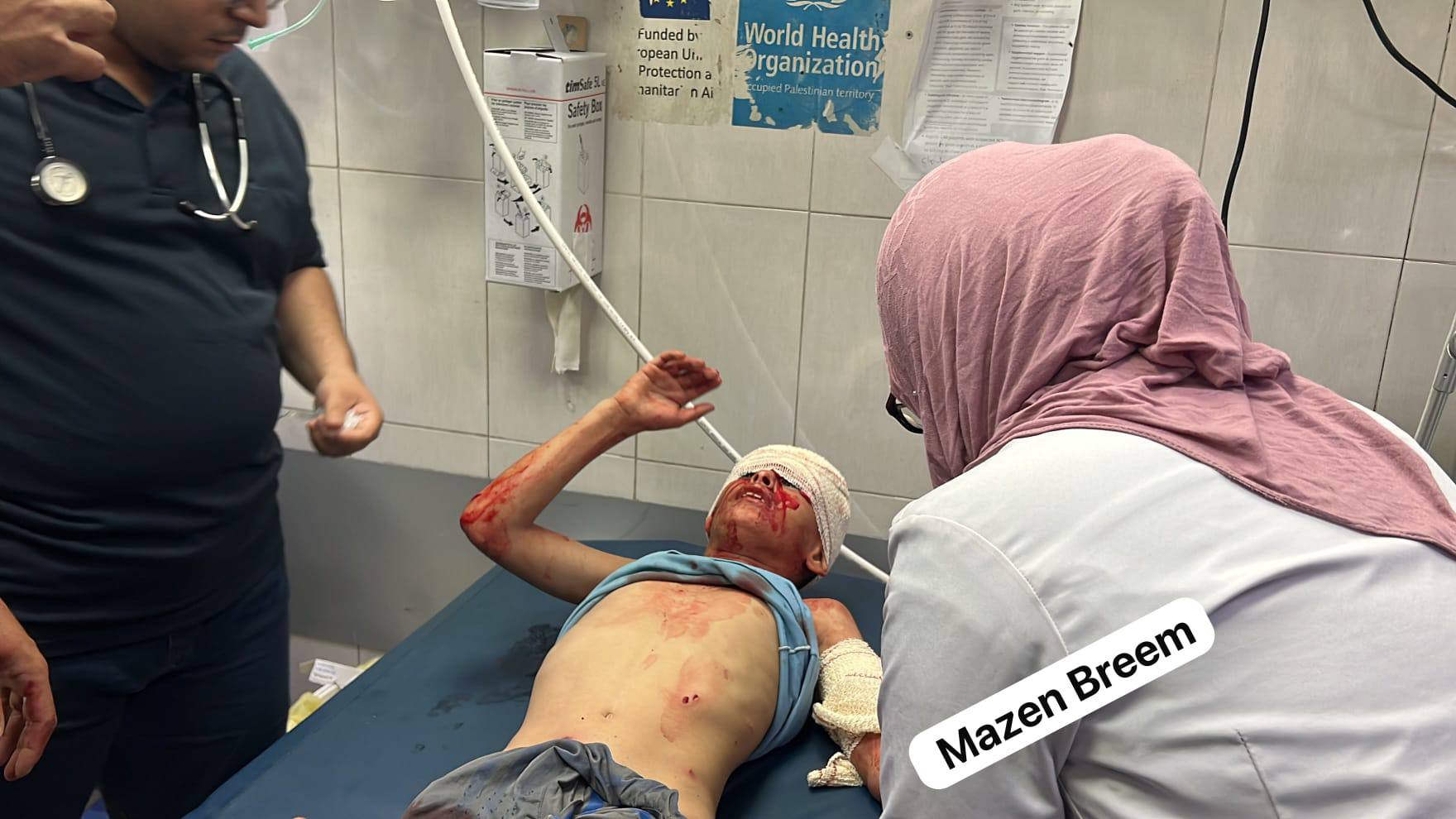 Thumbnail preview image for the video titled: Child injured in deadly Israeli drone strike on northern Khan Younis